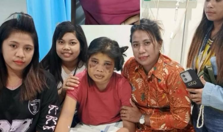 Ketua STTI Kupang Tawarkan Beasiswa Penuh untuk Intan, Korban Penyiksaan Majikan di Batam